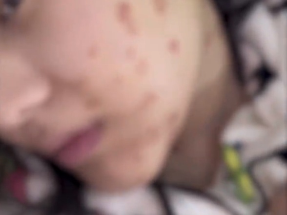  宠物市场隐忧曝光；18岁女生购猫后染病，商家责任引热议。 健康养生