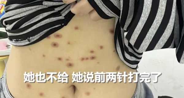  宠物市场隐忧曝光；18岁女生购猫后染病，商家责任引热议。 健康养生